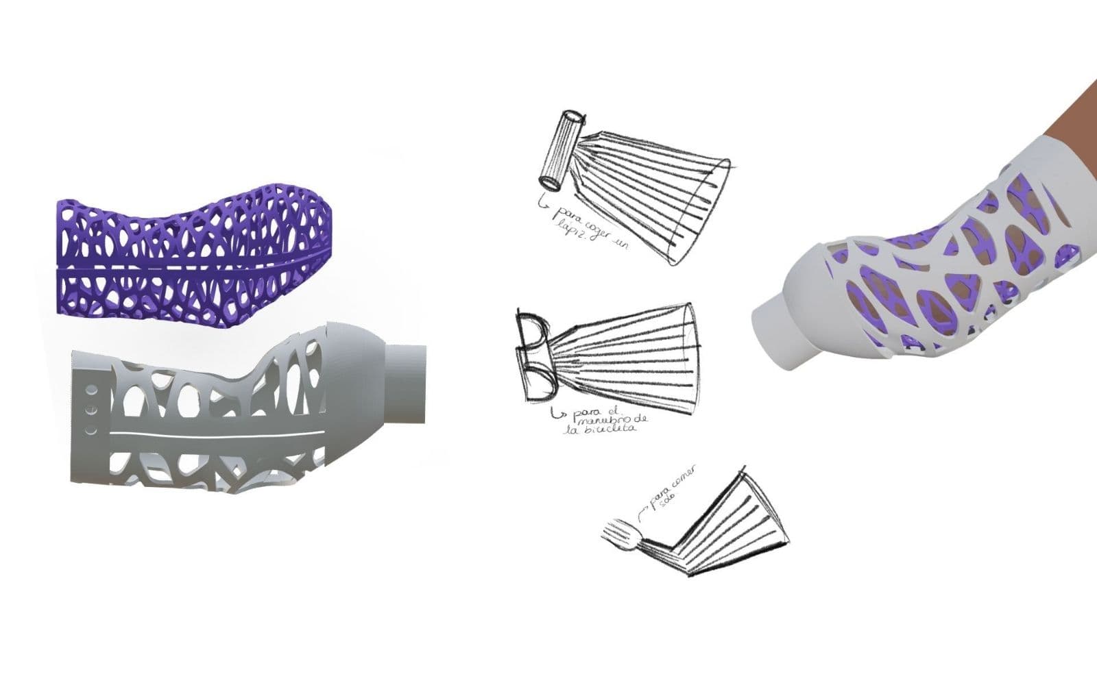 Sistemul de socket protetic printat 3D câștigă un premiu Dyson